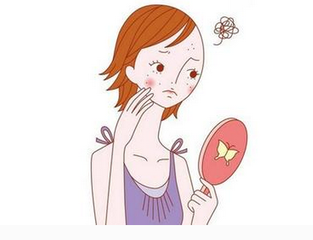 脸上长青春痘如何治疗